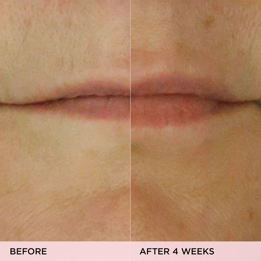 the kissu lip treatment
volume-restoring lip serum